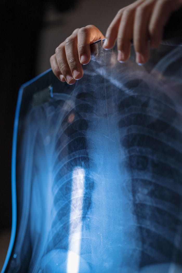 Close-up of hands holding a chest X-ray film, highlighting ribcage details.