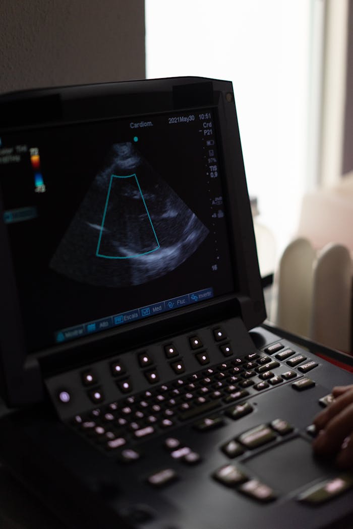 Close-up of an ultrasound machine screen showing a cardiogram in a clinical environment.